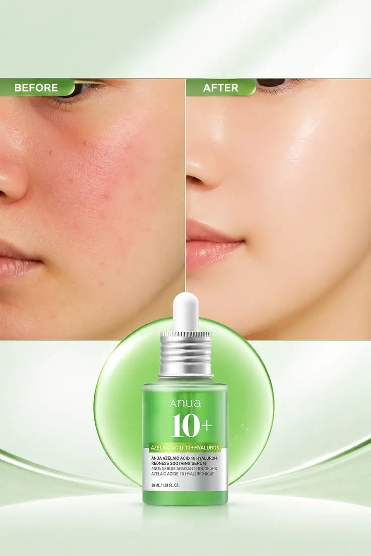 ANUA AZELAIC ACID 10+hyaluron redness soothing serum The Pretify